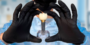 Імплантація зубів без страху: що це, кому потрібна і як проходить